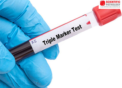 Quadruple Marker | Sugar Test In Agra - scientificpathology.com