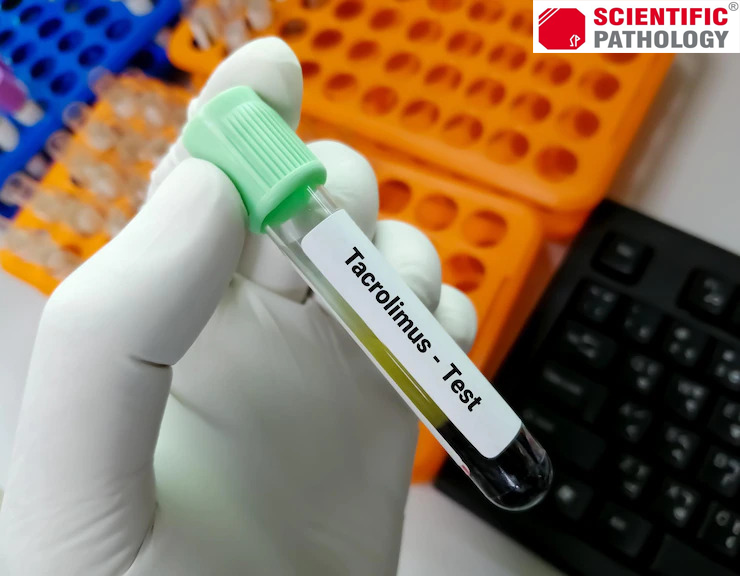 Blood Test In Agra | Mobile App Download - Scientificpathology.com 