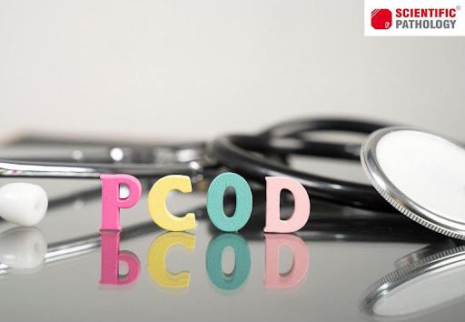 PCOD- Symptoms, Diagnosis & Prevention