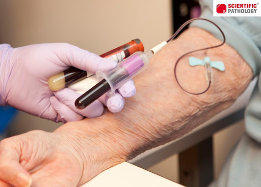 Importance of Proper Phlebotomy Procedure