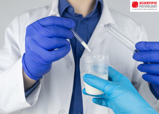 SQA -V Gold -The Best Technology for Sperm Analysis Testing